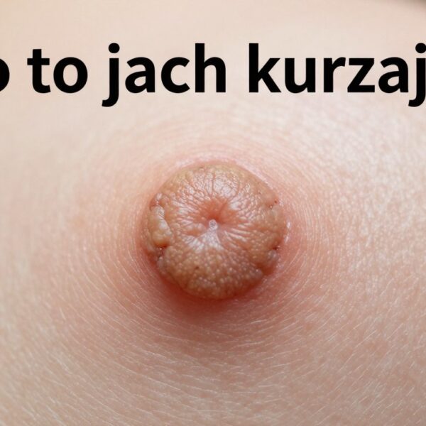 Co to jest kurzajka? Jak powstaje, jak wygląda i czy można się nią zarazić